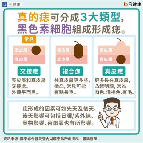 脖子突然長很多痣|是痣？皮膚癌？還是什麼？常見Q&A解惑！醫教揪出「。